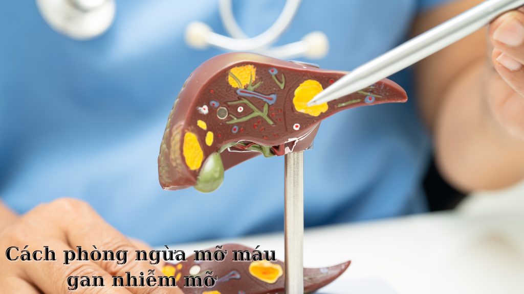 Cách phòng ngừa mỡ máu gan nhiễm mỡ