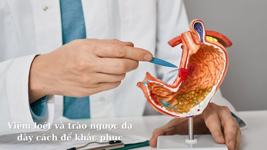 Viêm loét và trào ngược dạ dày cách để khắc phục