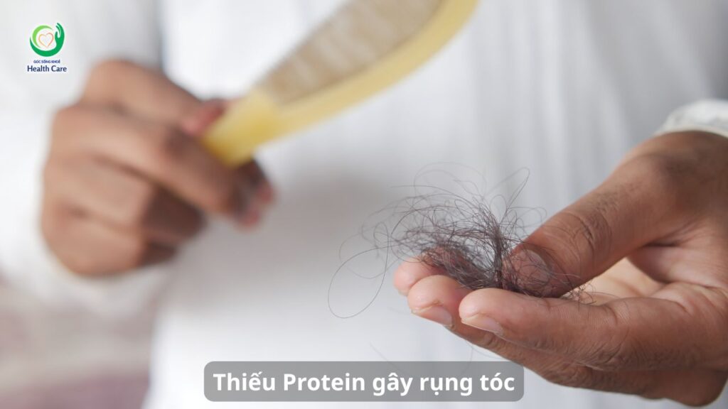 Thiếu Protein gây rụng tóc