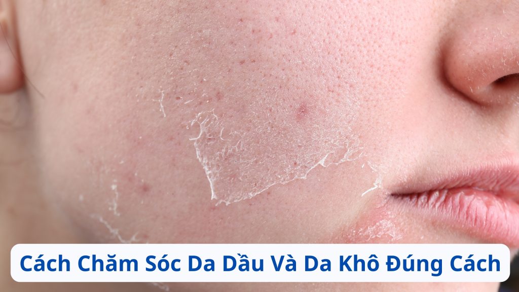 Cách Chăm Sóc Da Dầu Và Da Khô Đúng Cách